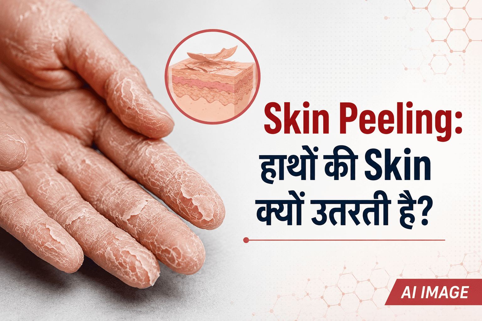 Skin Peeling